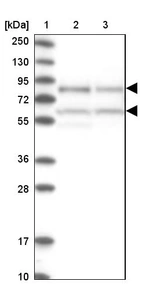 Lane 1: Marker [kDa] 250, 130, 95, 72, 55, 36, 28, 17, 10_br/_Lane 2: Human cell line RT-4_br/_Lane 3: Human cell line U-251MG sp