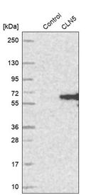 Western blot analysis in control (vector only transfected HEK293T lysate) and CLN5 over-expression lysate (Co-expressed with a C-terminal myc-DDK tag (~3.1 kDa) in mammalian HEK293T cells, LY416612).