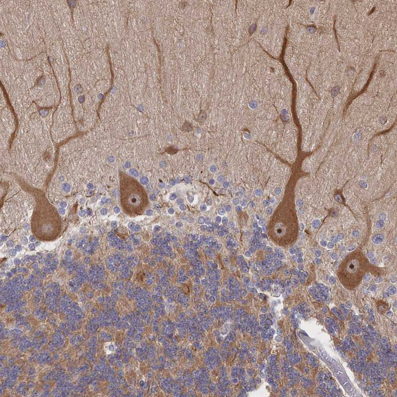 Anti-DNAJA4 Antibody