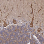 Anti-DNAJA4 Antibody