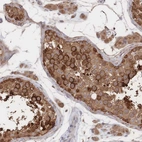Immunohistochemical staining of human testis shows moderate to strong cytoplasmic positivity in cells in seminiferous ducts.
