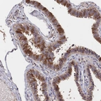 Immunohistochemical staining of human fallopian tube shows strong cytoplasmic positivity in glandular cells.