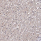 Immunohistochemical staining of human liver shows negative to very weak cytoplasmic positivity in hepatocytes.