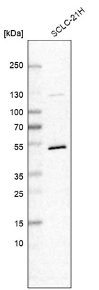 Western blot analysis in human cell line SCLC-21H.