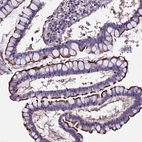 Anti-USB1 Antibody