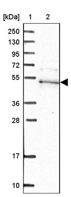 Lane 1: Marker [kDa] 250, 130, 95, 72, 55, 36, 28, 17, 10_br/_Lane 2: Human cell line RT-4
