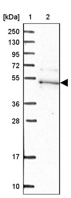 Lane 1: Marker [kDa] 250, 130, 95, 72, 55, 36, 28, 17, 10_br/_Lane 2: Human cell line RT-4