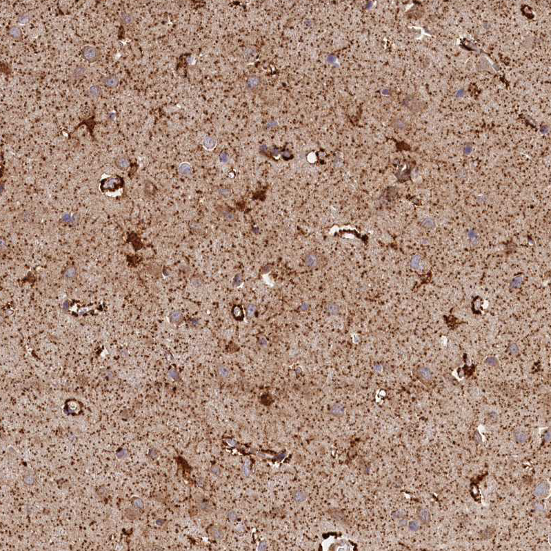 Anti-AKTIP Antibody