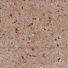 Anti-AKTIP Antibody