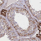 Immunohistochemical staining of human testis shows strong cytoplasmic granular positivity in cells in seminiferous ducts.