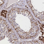Immunohistochemical staining of human testis shows strong cytoplasmic granular positivity in cells in seminiferous ducts.