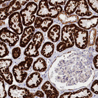 Immunohistochemical staining of human kidney shows strong cytoplasmic granular positivity in cells in tubules.