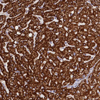 Immunohistochemical staining of human liver shows strong cytoplasmic granular positivity in hepatocytes.