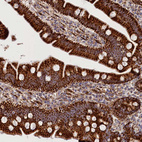 Immunohistochemical staining of human duodenum shows strong cytoplasmic granular positivity in glandular cells.