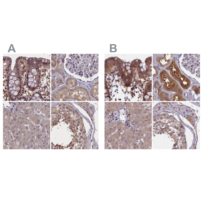 Anti-NUBP1 Antibody