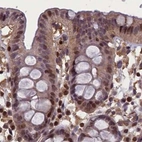 Immunohistochemical staining of human colon using Anti-NUBP1 antibody HPA041799.