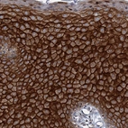 Immunohistochemical staining of human skin shows strong membranous positivity in squamous epithelial cells.