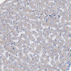 Immunohistochemical staining of human liver shows no positivity in hepatocytes as expected.