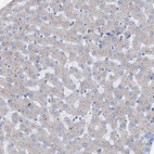 Anti-LYPD3 Antibody