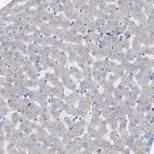 Immunohistochemical staining of human liver shows no positivity in hepatocytes as expected.