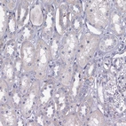 Immunohistochemical staining of human kidney shows no positivity in cells in tubules as expected.