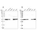 Western blot analysis using Anti-NUBP1 antibody HPA041799 (A) shows similar pattern to independent antibody HPA041656 (B).