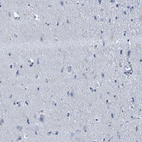 Immunohistochemical staining of human cerebral cortex shows no positivity in neurons as expected.