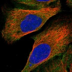 Immunofluorescent staining of human cell line U-2 OS shows localization to cytosol.