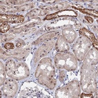 Anti-TSSC4 Antibody