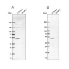 Western blot analysis using Anti-IST1 antibody HPA041802 (A) shows similar pattern to independent antibody HPA054532 (B).