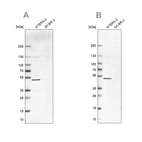 Western blot analysis using Anti-IST1 antibody HPA041802 (A) shows similar pattern to independent antibody HPA054532 (B).