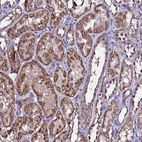 Anti-DIS3L Antibody