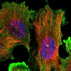 Immunofluorescent staining of human cell line U-251 MG shows localization to plasma membrane, cytosol & centrosome.