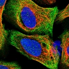 Immunofluorescent staining of human cell line U-2 OS shows localization to cytosol & actin filaments.