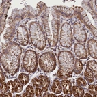 Anti-IFT122 Antibody