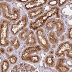 Anti-TBC1D1 Antibody