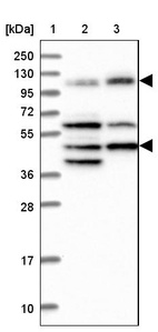 Lane 1: Marker [kDa] 250, 130, 95, 72, 55, 36, 28, 17, 10_br/_Lane 2: Human cell line RT-4_br/_Lane 3: Human cell line U-251MG sp