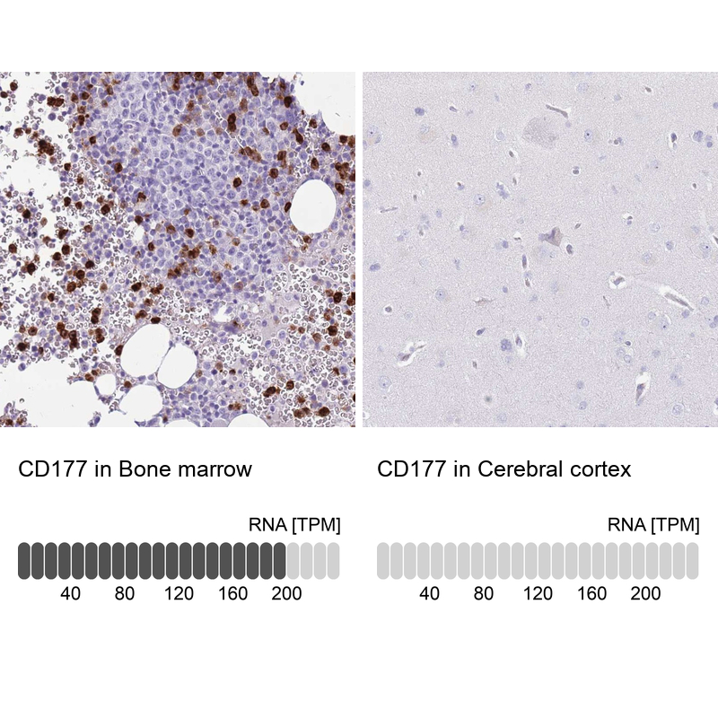 Anti-CD177 Antibody