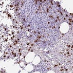 Immunohistochemical staining of human bone marrow shows high expression.