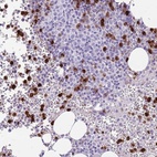 Anti-CD177 Antibody