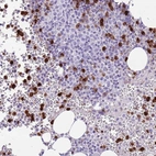 Immunohistochemical staining of human bone marrow shows high expression.