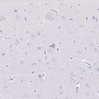 Immunohistochemical staining of human cerebral cortex shows low expression as expected.