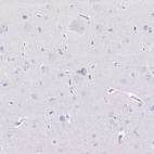 Immunohistochemical staining of human cerebral cortex shows low expression as expected.