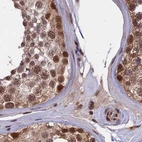 Immunohistochemical staining of human testis using Anti-POLR2C antibody HPA041826.