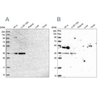 Western blot analysis using Anti-POLR2C antibody HPA041826 (A) shows similar pattern to independent antibody HPA040919 (B).