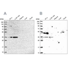 Western blot analysis using Anti-POLR2C antibody HPA041826 (A) shows similar pattern to independent antibody HPA040919 (B).