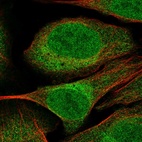 Anti-CUEDC2 Antibody