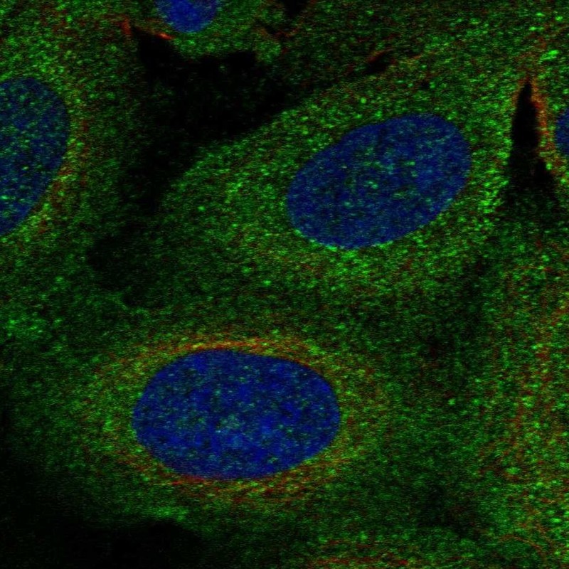 Anti-TBC1D2B Antibody