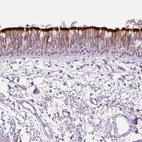 Immunohistochemical staining of human bronchus shows strong membranous positivity in respiratory epithelial cells.