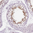 Immunohistochemical staining of human testis shows moderate cytoplasmic positivity in cells in seminiferous ducts.